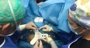 البروفيسور وفيق الوتار يجري عملية البواسير دون جراحة  من خلال تقنية الـ  Doppler guid Hemorroid artery ligashion