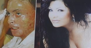 خنقها ووضعها بالماء المغلي..حكاية الجميلة كارن حتي من الشهرة للتشوه!!