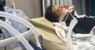 نقيب الموسيقيين المنيا عن إسماعيل الليثي:” النزيف تراجع وحالته حرجه”