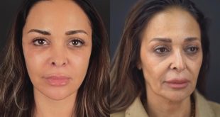 داليا البحيري تُعلن عن سبب اجراء عملية تجميل لوجهها؟!