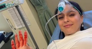 استئصال الورم ونجاح العملية.. جيمري بايسال من غرفة الجراحة