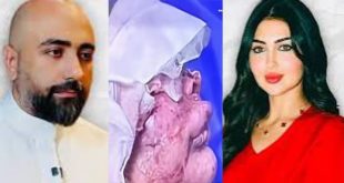 سكب عليها الزيت المغلي واقتلع عينها.. دكتور التجميل العقيدي اعتدى على زوجته طبيبة التخدير فيروزة وغضب بالعراق !!